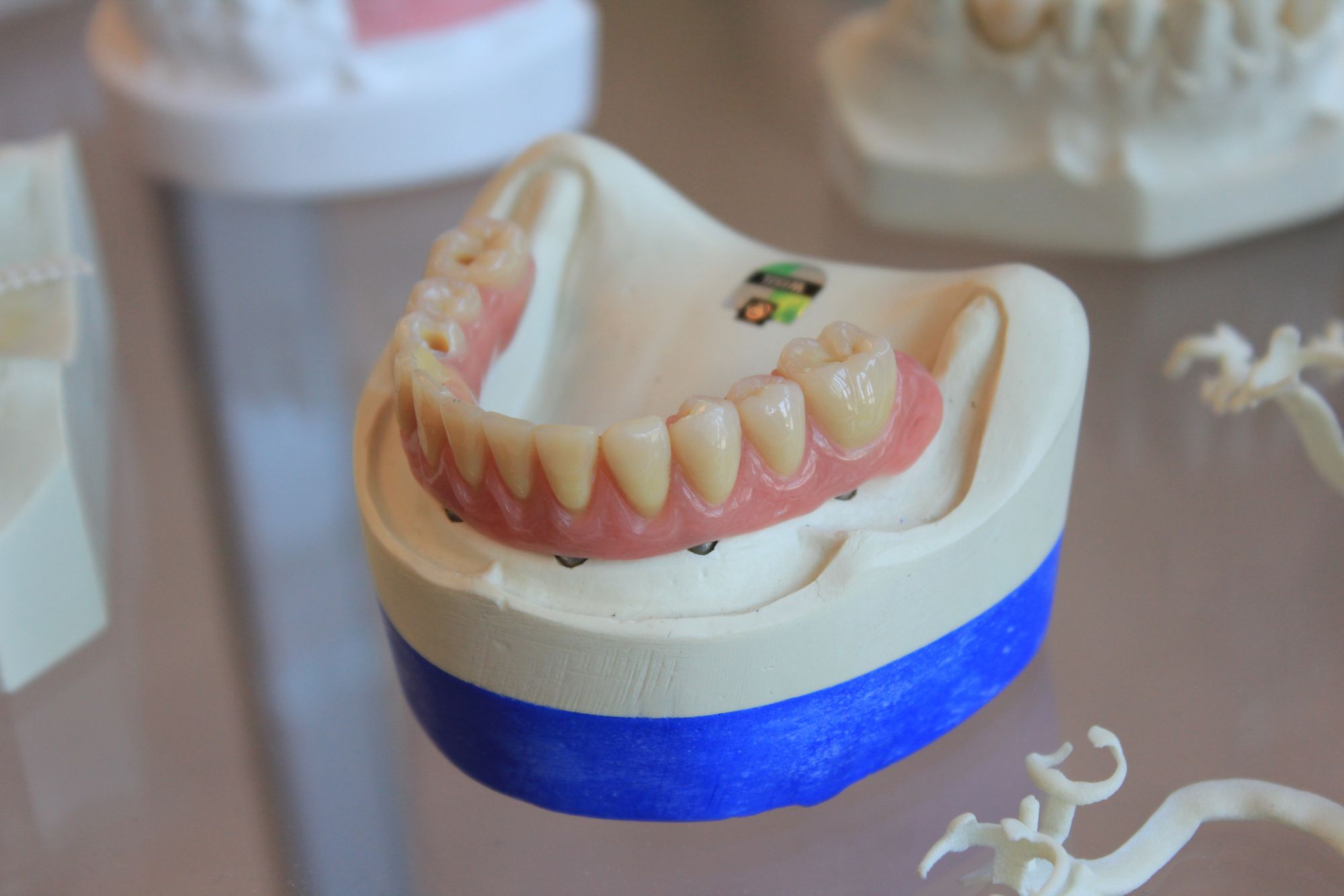 Tản mạn về chiếc răng khôn - P2